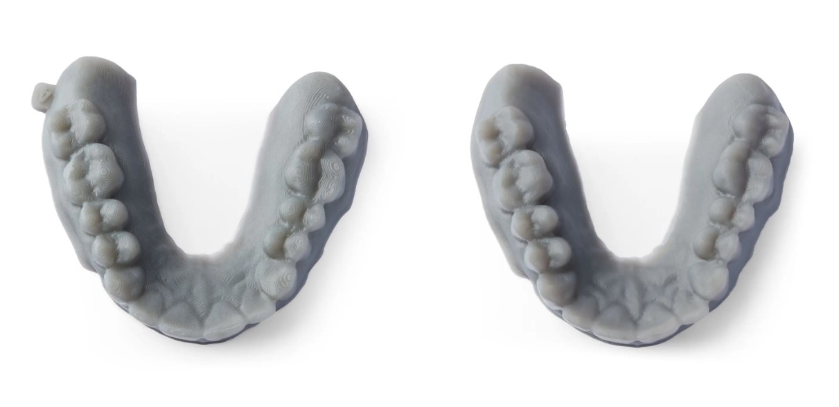 Comparison of dental model prints with different layer height